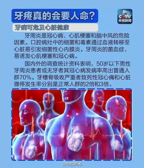 牙疼不可輕視，可能會(huì)要人命 